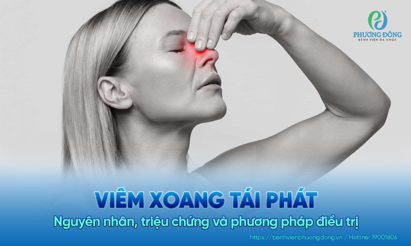 Viêm xoang tái phát: Nguyên nhân, triệu chứng và phương pháp điều trị
