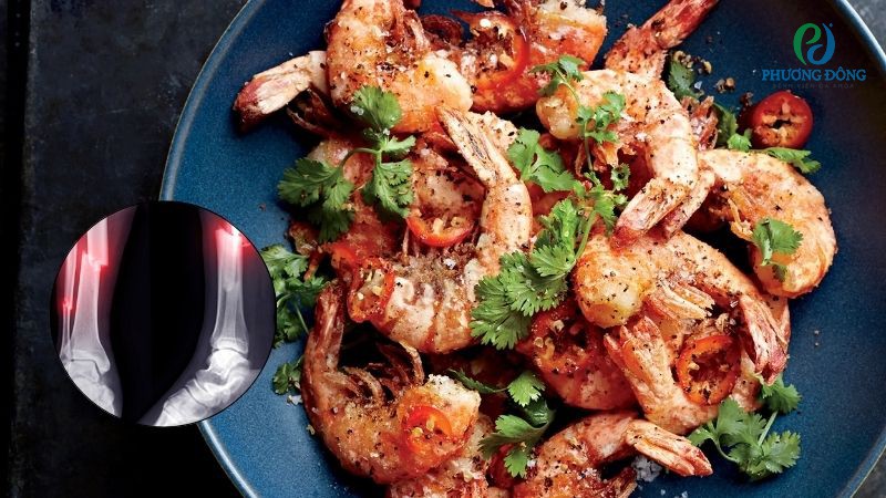 Người bệnh gãy xương vẫn có thể ăn tôm nhưng chú ý liều lượng sử dụng