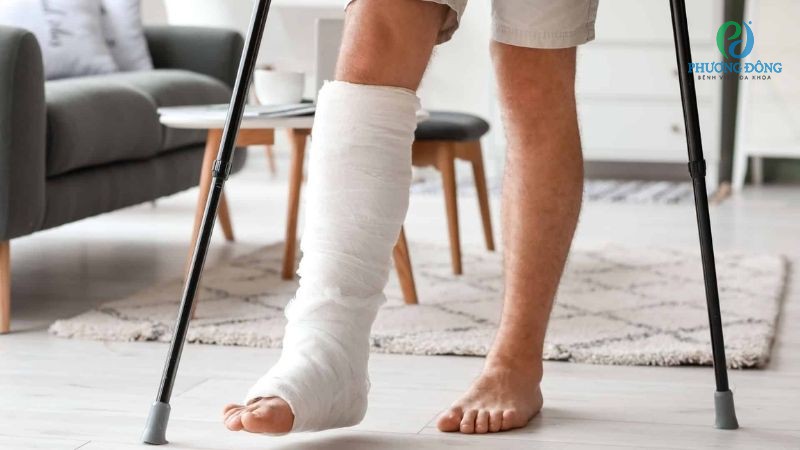 Mọi vị trí xương bị gãy đều có thể gây nguy hiểm cho sức khoẻ