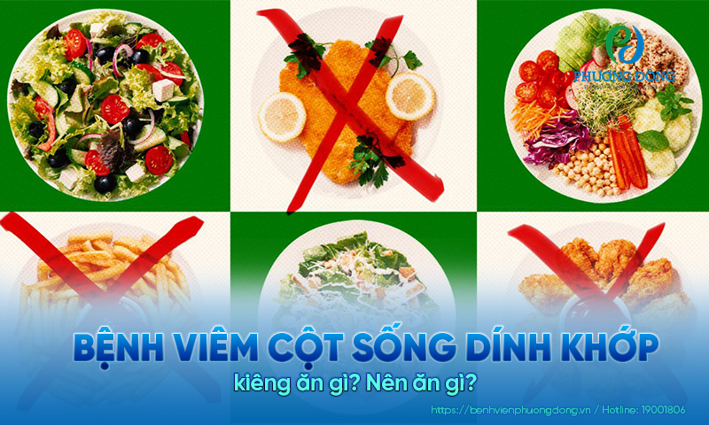 Bệnh viêm cột sống dính khớp kiêng ăn gì? Nên ăn gì?