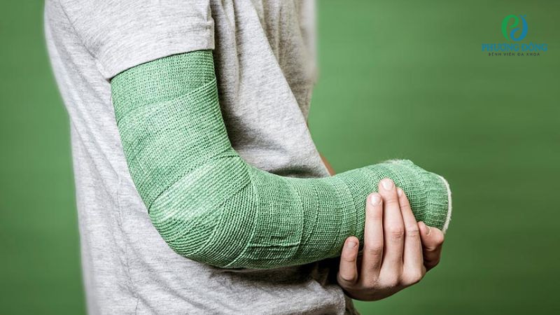 Một số lưu ý cần biết trong quá trình bó bột