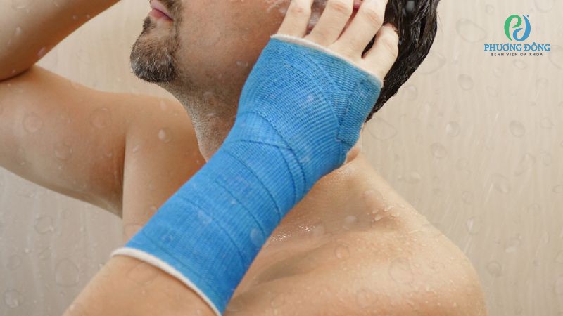 Hướng dẫn chăm sóc bột bó phòng ngừa biến chứng