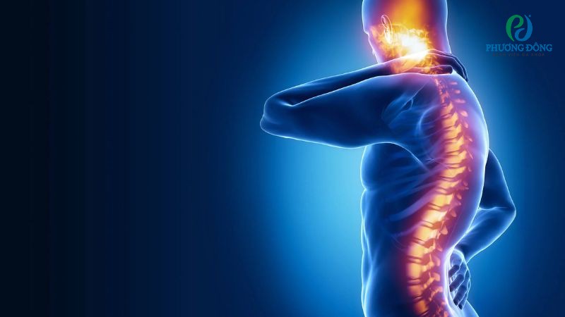 Tổn thương tủy sống làm tăng nguy cơ suy giảm chức năng đĩa đệm cột sống, dây chằng