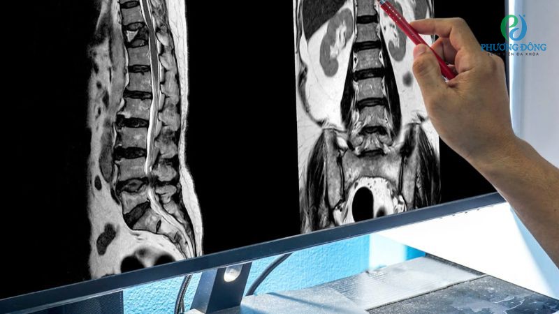 Phương pháp chẩn đoán tổn thương lâm sàng