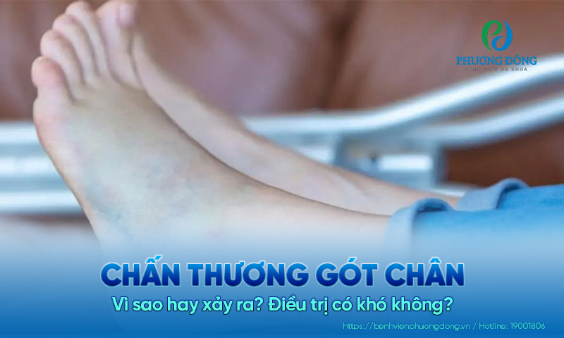 Chấn thương gót chân: Vì sao hay xảy ra? Điều trị có khó không?