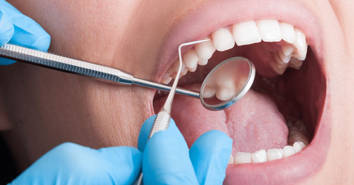 Sau khi khám trong miệng bác sĩ có thể thấy các triệu chứng bất thường