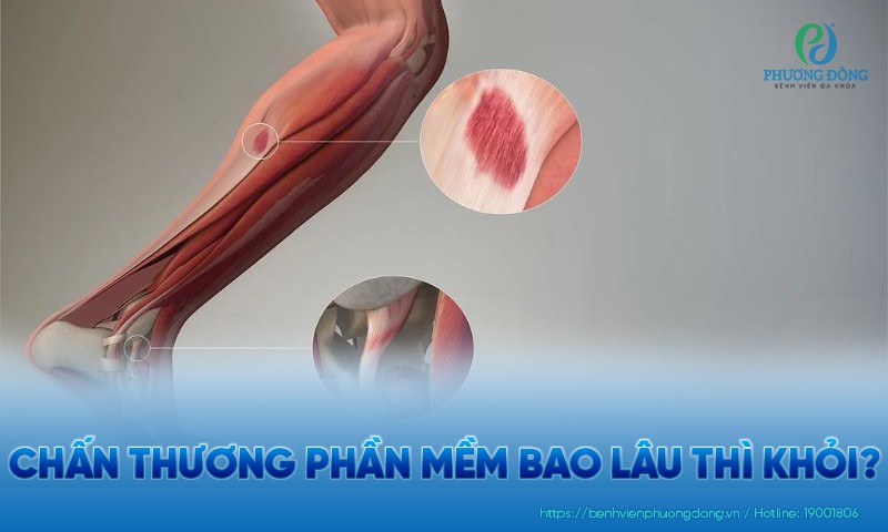 Chấn thương phần mềm bao lâu thì khỏi? Phác đồ điều trị