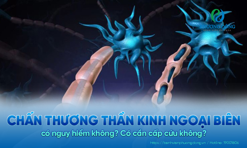Chấn thương thần kinh ngoại biên có nguy hiểm không? Có cần cấp cứu không?