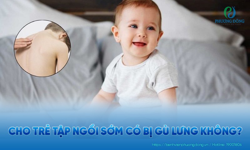 Cho trẻ tập ngồi sớm có bị gù lưng không? Thời điểm tập ngồi phù hợp