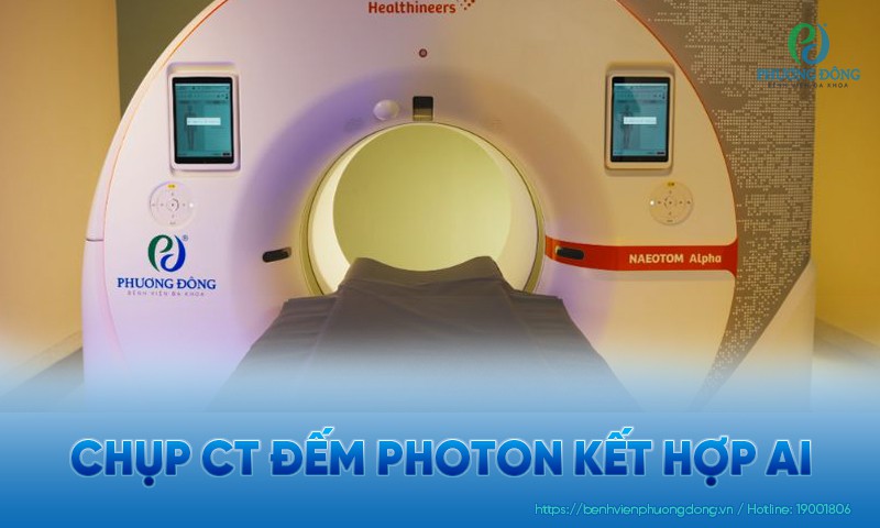 Chụp CT đếm photon kết hợp với AI: Ưu điểm và ai nên chụp?