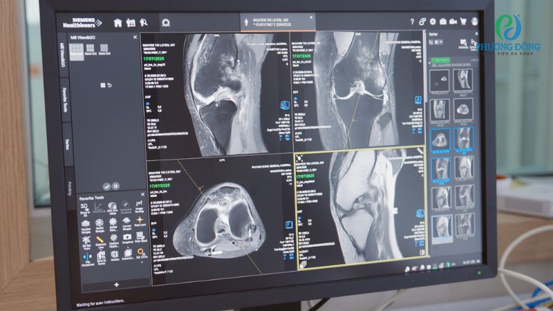 Ưu điểm của thiết bị CT đếm photon tích hợp AI