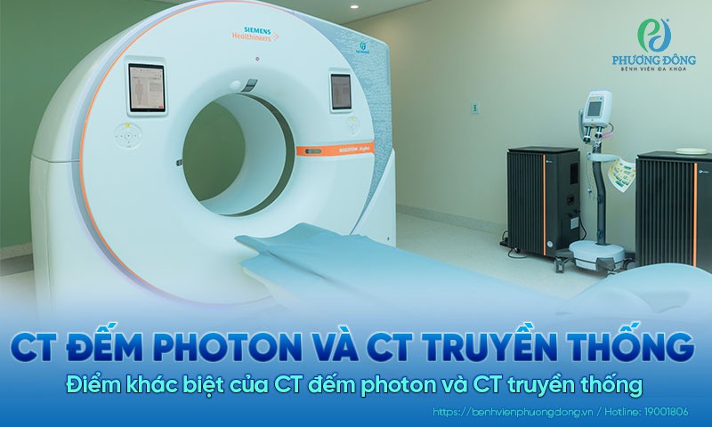 Điểm khác biệt giữa CT đếm photon và CT truyền thống 
