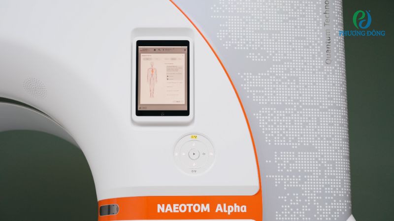 Ưu điểm khi chụp CT đếm photon ít phóng xạ
