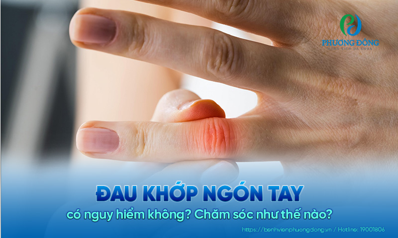 Đau khớp ngón tay có nguy hiểm không? Chăm sóc như thế nào?