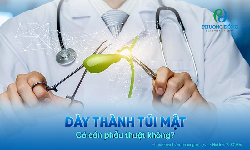 Dày thành túi mật có cần phẫu thuật không?