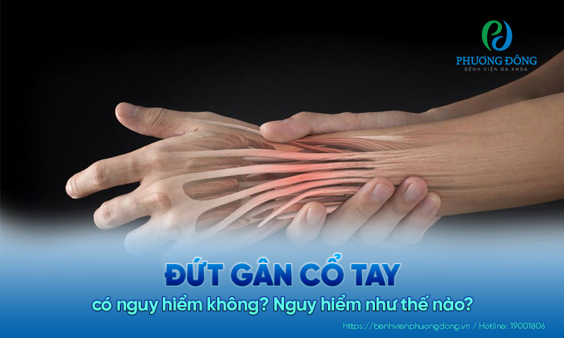 Đứt gân cổ tay có nguy hiểm không? Nguy hiểm như thế nào?