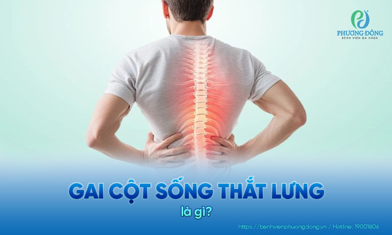 Nguyên nhân hình thành gai cột sống thắt lưng