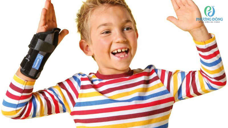 Tiến hành nẹp xương đối với vị trí gãy cần cử động linh hoạt