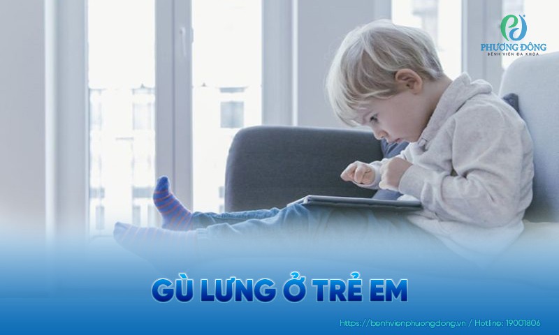 Gù lưng ở trẻ em: Nguyên nhân, triệu chứng và cách điều trị