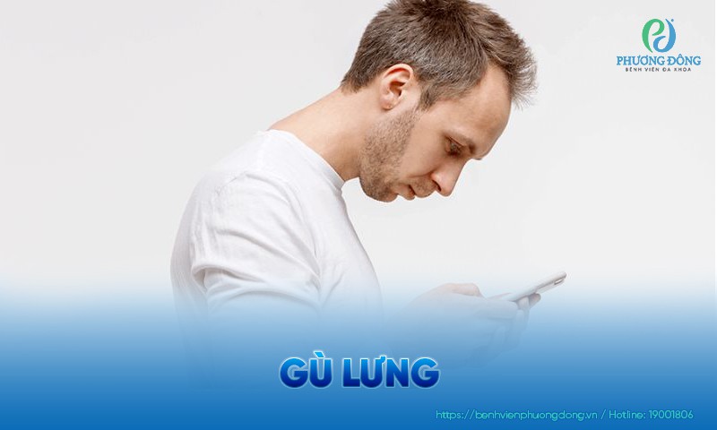 Gù lưng: Nguyên nhân, triệu chứng và hướng điều trị