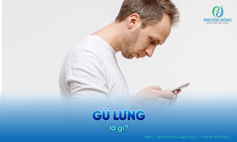 Gù lưng là tình trạng cột sống cong gập quá mức về phía trước