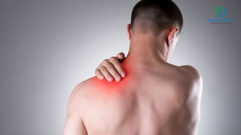 Biểu hiện triệu chứng lưng gù nghiêm trọng