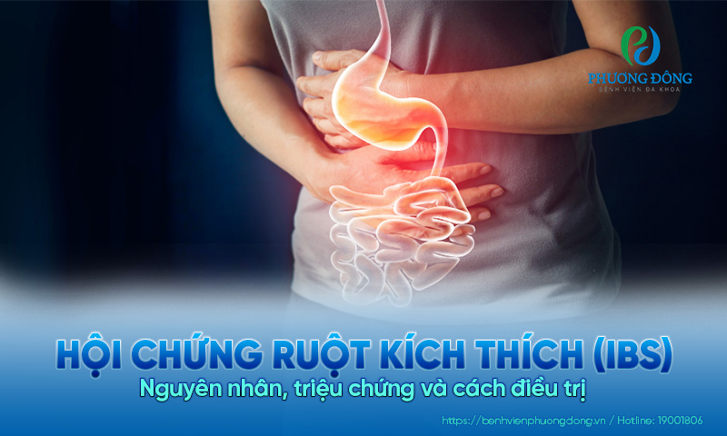 Hội chứng ruột kích thích (IBS): Nguyên nhân, triệu chứng và cách điều trị 