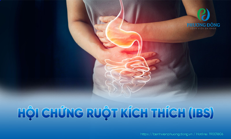Ruột kích thích là bệnh lý thường gặp