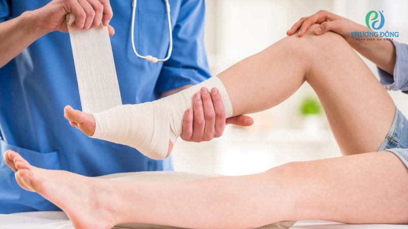 Gãy xương bàn chân bao lâu hết sưng?