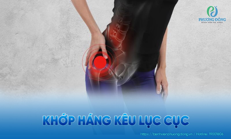 Khớp háng kêu lục cục: Nguyên nhân, triệu chứng và điều trị
