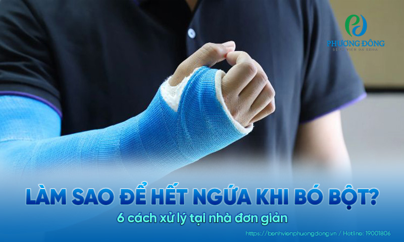 Làm sao để hết ngứa khi bó bột? 6 cách xử lý tại nhà đơn giản