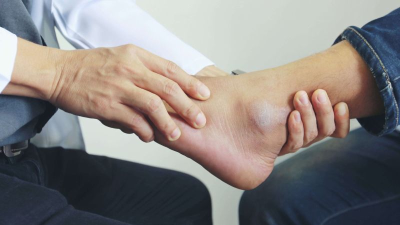 Bạn phải mất ít nhất 2 tháng để phục hồi sau phẫu thuật