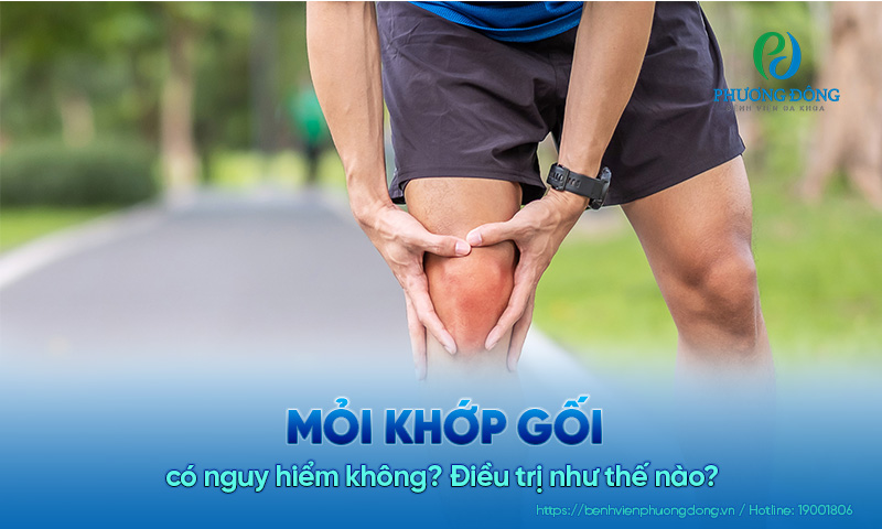 Mỏi khớp gối có nguy hiểm không? Điều trị như thế nào?