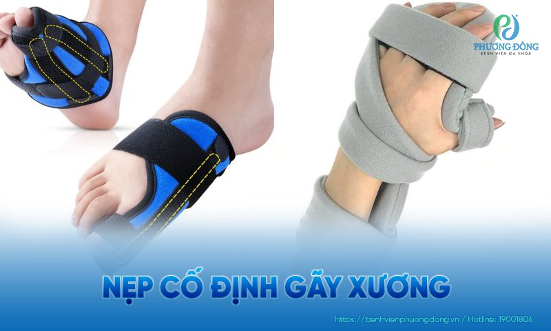 Nẹp cố định gãy xương là gì? Các kỹ thuật cố định xương bị gãy