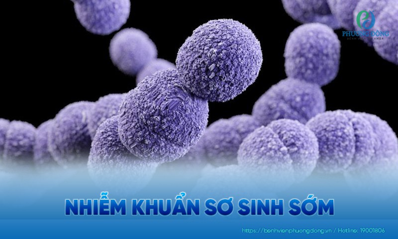 Nhiễm khuẩn sơ sinh sớm: Nguyên nhân, dấu hiệu và điều trị