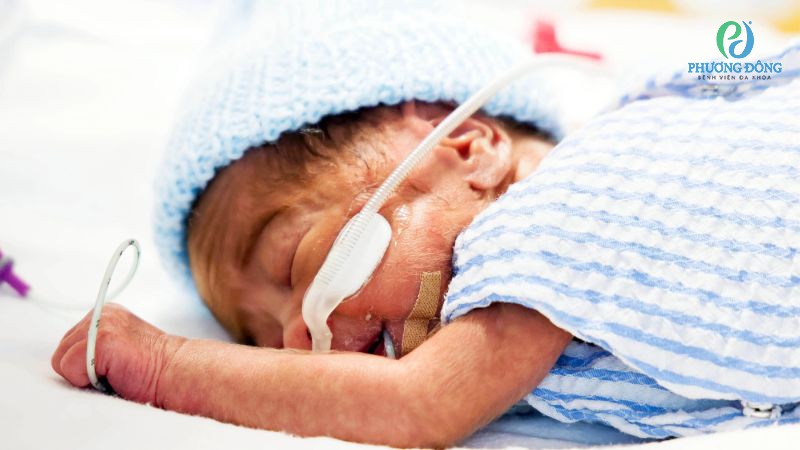 Nhận biết trẻ sơ sinh bị nhiễm khuẩn sớm trong 72 giờ đầu