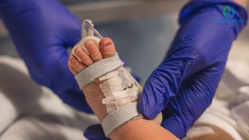 Hướng dẫn điều trị nhiễm khuẩn sơ sinh theo nguyên nhân