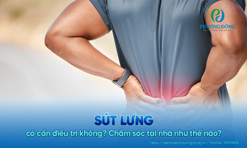 Sút lưng có cần điều trị không? Chăm sóc tại nhà như thế nào?