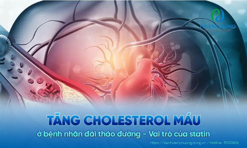 Tăng cholesterol máu ở bệnh nhân đái tháo đường - Vai trò của statin