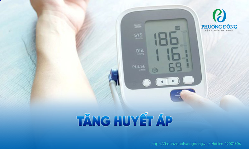 Huyết áp được coi là tăng nếu huyết động ≥ 140/90 mmHg