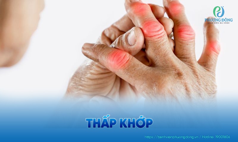 Thấp khớp: Triệu chứng, nguyên nhân và cách  điều trị