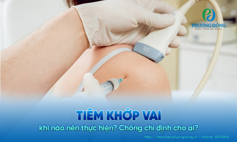 Tiêm khớp vai khi nào nên thực hiện? Chống chỉ định cho ai?
