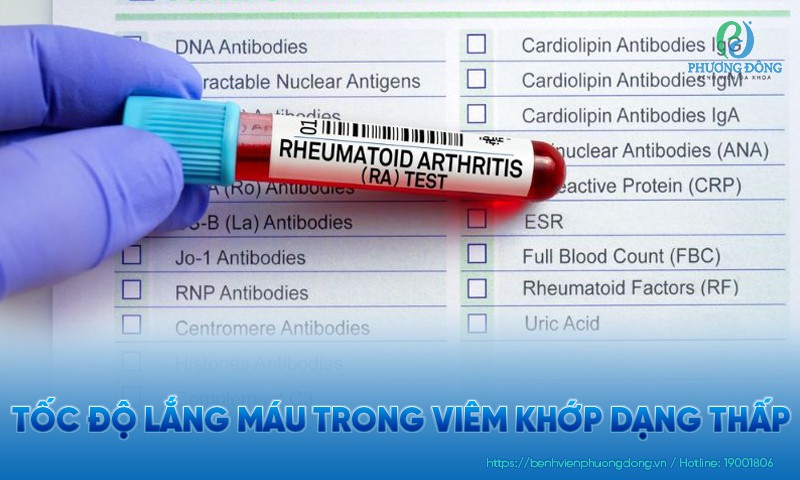 Tốc độ máu lắng trong viêm khớp dạng thấp có ý nghĩa gì?