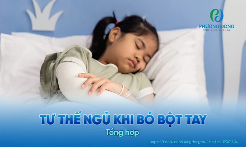 Tổng hợp các tư thế ngủ khi bó bột tay & Lưu ý khi thực hiện