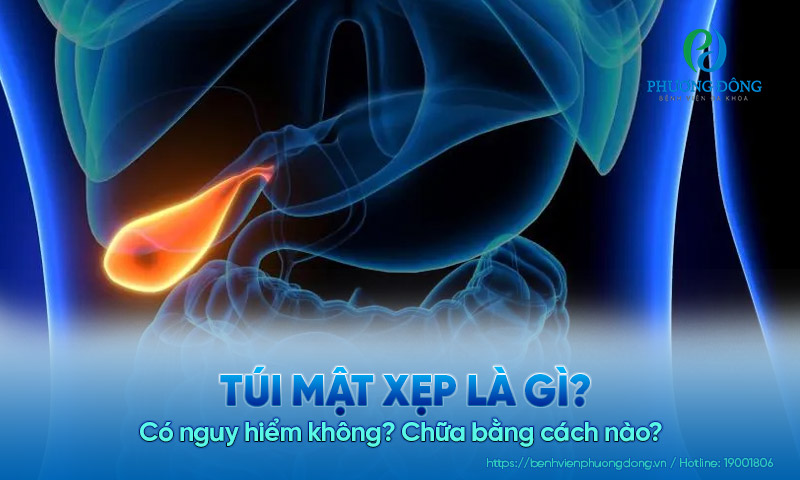 Túi mật xẹp là gì? Có nguy hiểm không? Chữa bằng cách nào?