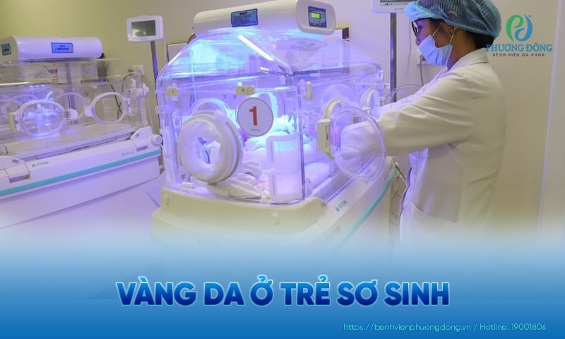 Vàng da ở trẻ sơ sinh: Phân biệt vàng da sinh lý và bệnh lý