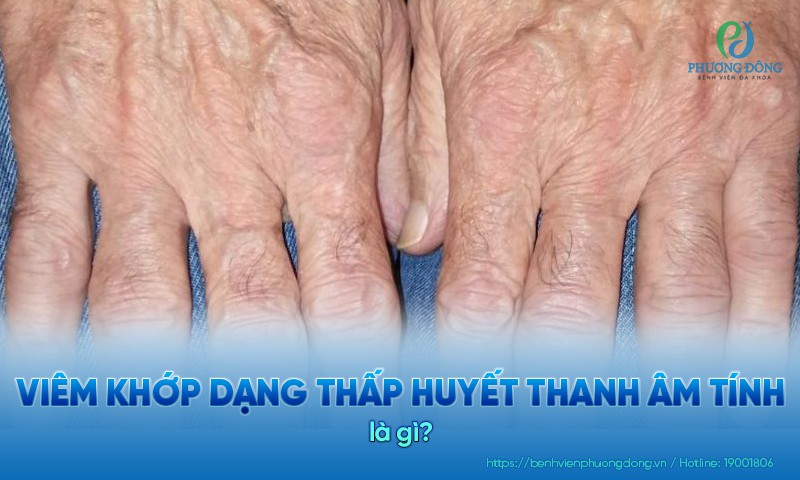 Viêm khớp dạng thấp huyết thanh âm tính không có yếu tố dạng thấp hay kháng thể CCP