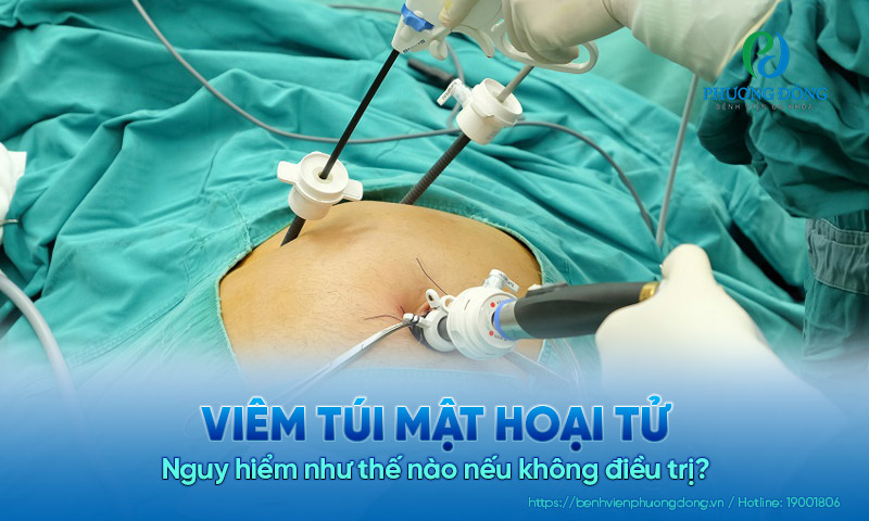 Viêm túi mật hoại tử nguy hiểm như thế nào nếu không điều trị?