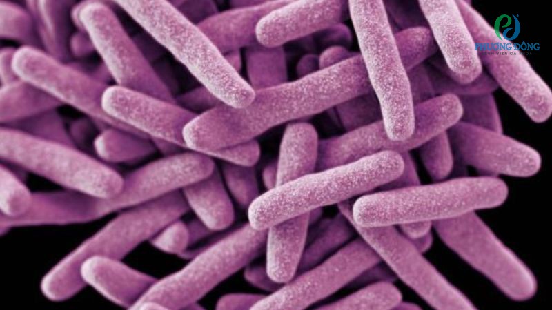 Lao xương cột sống có thể lây truyền sang người tương tự lao phổi