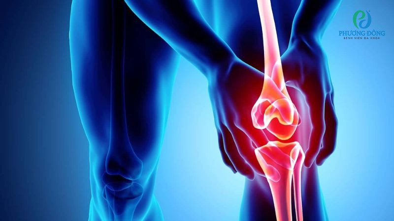 Gặp gỡ bác sĩ: Thoái hóa khớp gối có chữa khỏi được không? Gặp gỡ bác sĩ: Thoái hóa khớp gối có chữa khỏi được không?